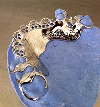 Chrome Dentures Image