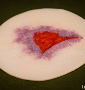 Silicone Wounds Image