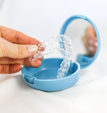O Clear Aligners Image