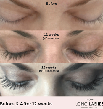 Long Lashes Eye Lash Enhancer Image