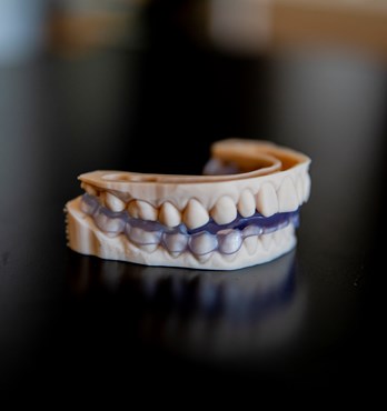 NOX Dental Splints Image