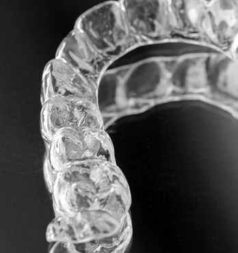 O Clear Aligners Image